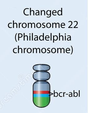 Changed chromosome 22.jpg
