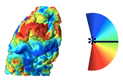 Information focntionnelle visuelle calquée sur une représentation surfacique 3D du pôle occipital