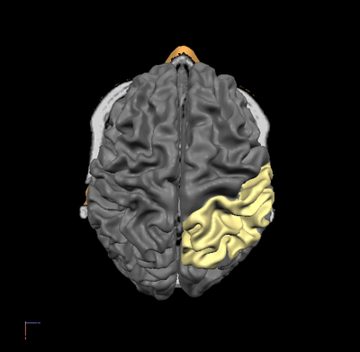 lobe parietal droit.png