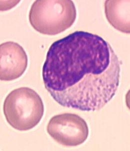 lymphocyteMO