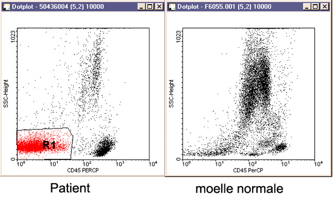 cd45normcas2.gif