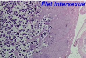 flet intersexue.jpg