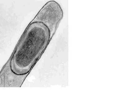 bacillus licheniformis.JPG