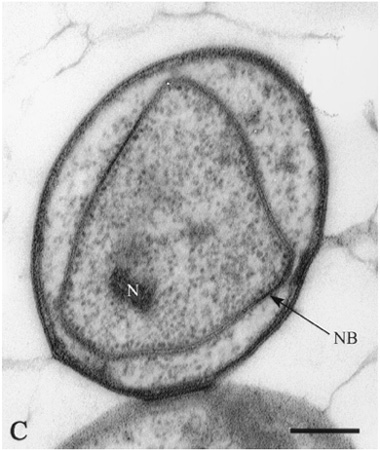 gemmata-like-bacterium.jpg