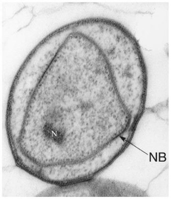 Gemmata obscuroglobus.jpg