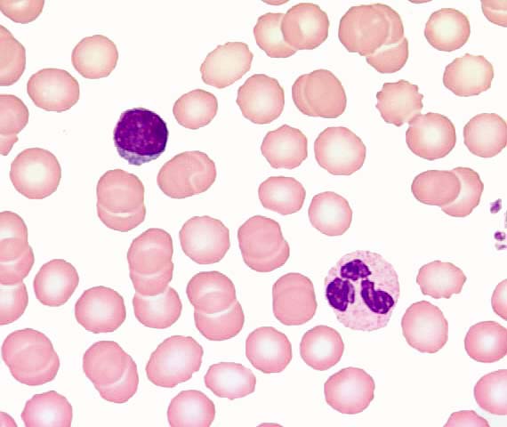 frottis sanguin_GB_3.jpg