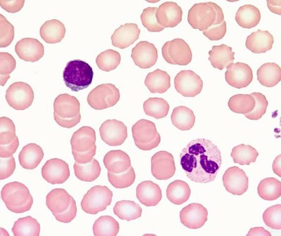 frottis sanguin_GB_3.jpg