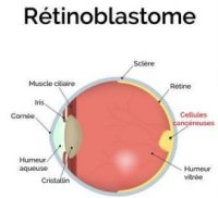Icone rétinoblastome