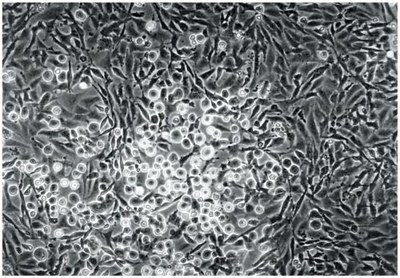 Foci et cellules normales.jpg