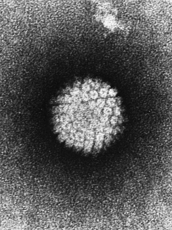 Papillomavirus - Futura sciences.jpg