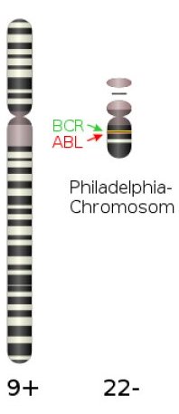 Chromosome philadelphie.jpg