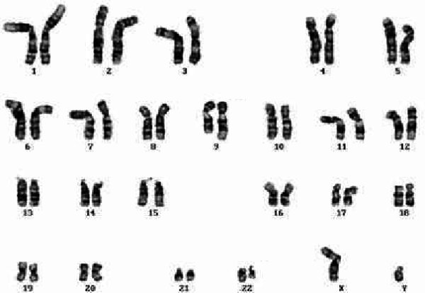 caryotype-cellule-lmc.jpg