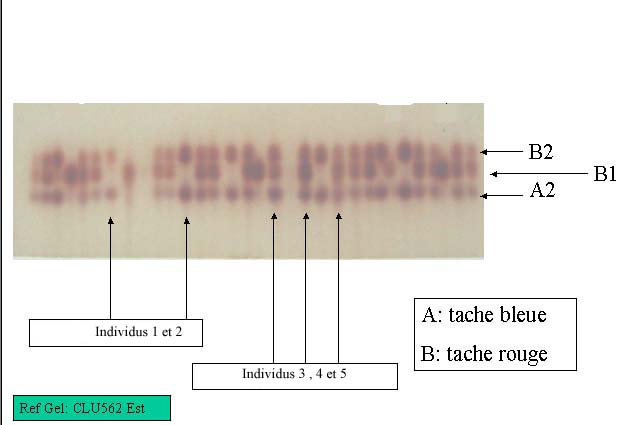 gel electrophorese.jpg