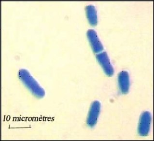 Levure Schizosaccharomyces Pombe.jpg