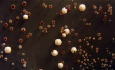 levures exposées aux UV 30s   detail