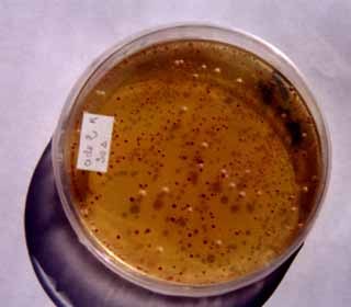 levures exposées aux UV 30s