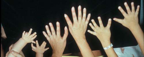Image de polydactyles-3.jpg