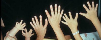 Image de polydactyles-3.jpg