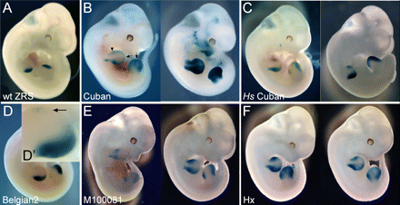 Transgenèse Mus ZRS-2.gif