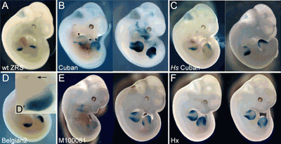 Transgenèse ZRS-2.gif