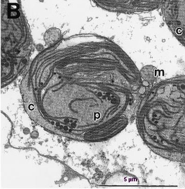 Cellule digestive d'Elysia.jpg