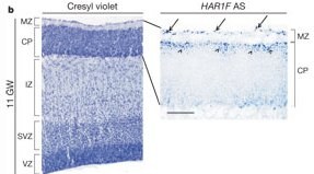 Coupe 11 semaines.jpg