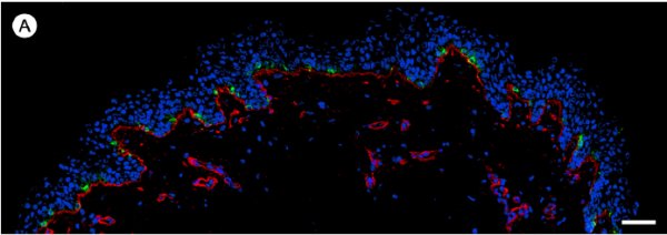 Densité mélanocytes1.jpg