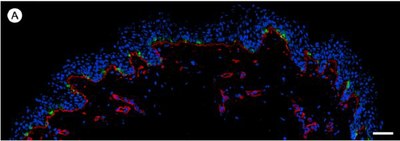 Densité mélanocytes1.jpg