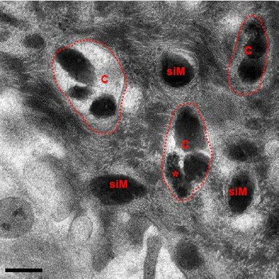 Mélénosomes isolés ou groupés.jpg