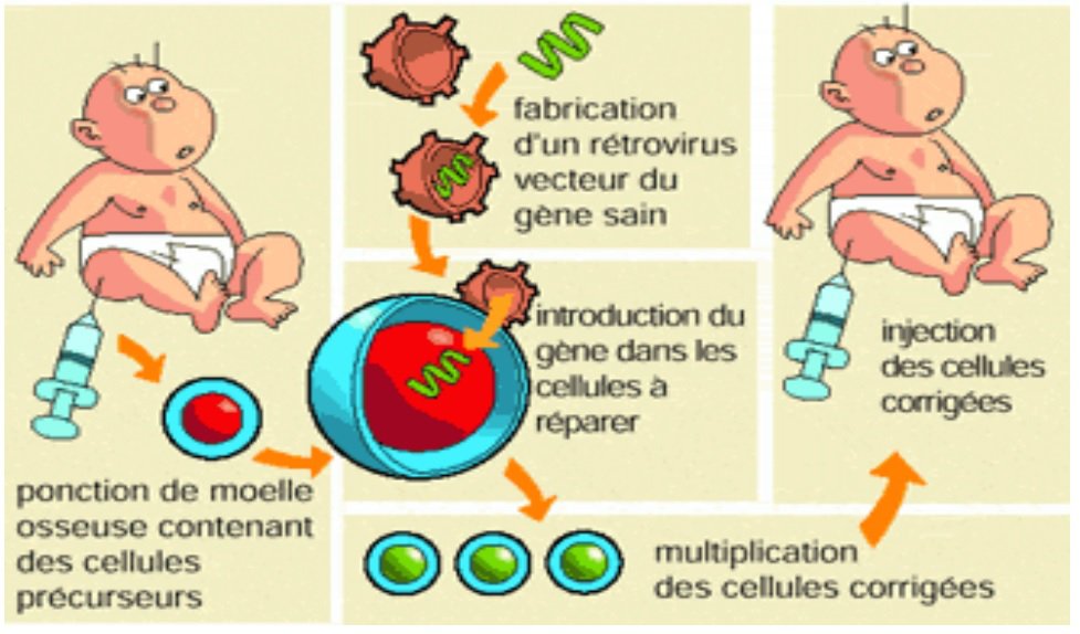 Etapes thérapie génique 1