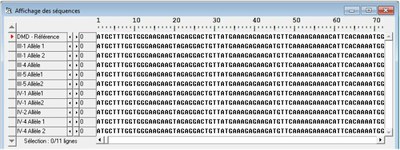 Alignement séquences Famille1.jpg