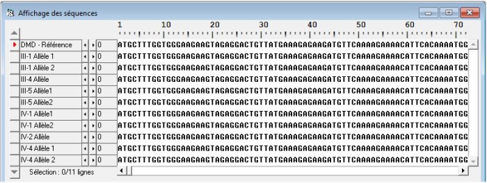 Alignement séquences Famille2.jpg