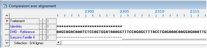 Famille4. Début délétion E48 Nucléique