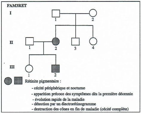 Image Famille3 Rétinite