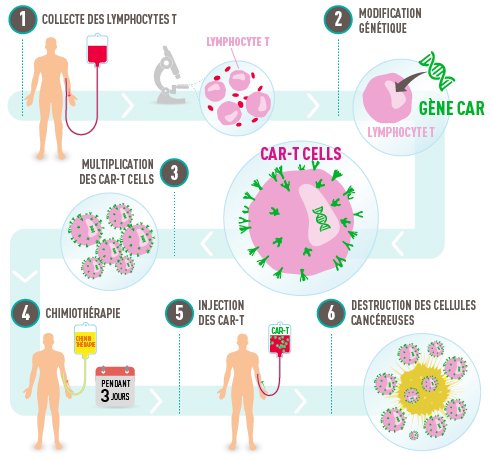 Les étapes du traitement