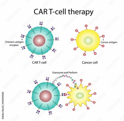 Mécanismes moléculaires de l’action des cellules Car T sur les cellules tumorales