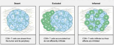 Trois phénotypes principaux de la tumeur