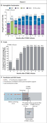 Patient2  Frangoul Evolution de la quantité totale d’hémoglobine du sang 