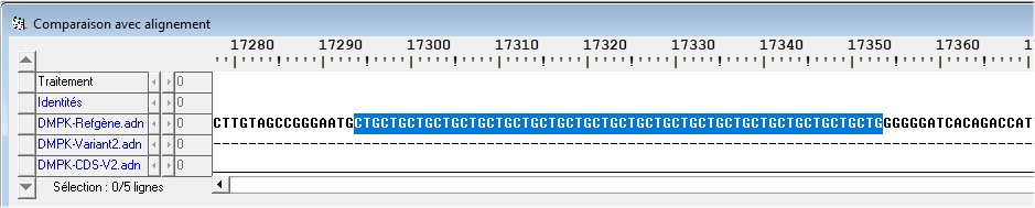 Position des répétitions de CTG.jpg