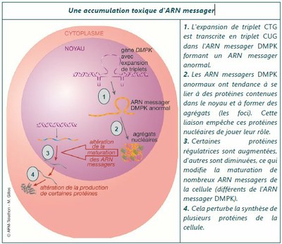 Accumulation toxique d'ARN messager