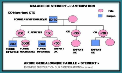 Anticipation Site maladie de Steinert