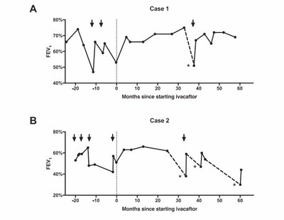 Evolution de la fonction pulmonaire