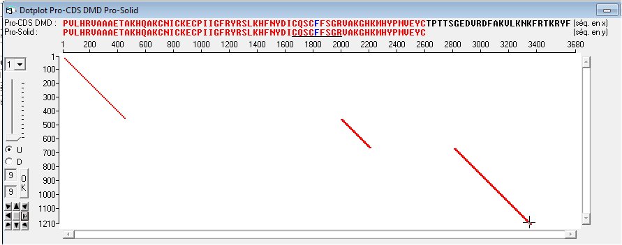 DMD vs Solid biosciences