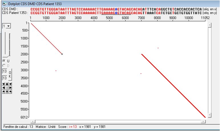 DotPlot CDS DMD vs CDS patient 1353