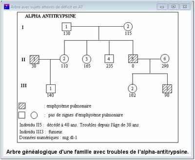 Arbre généalogique d'une famille avec troubles de l'alpha antitrypsine 