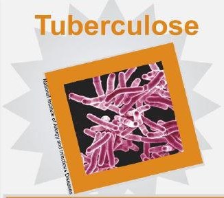 image preview tuberculose