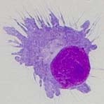 cellule dendritique