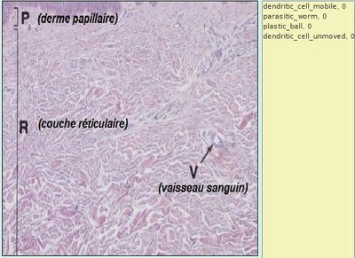 capture écran modèle cellules dendritiques
