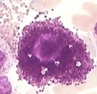 mastocyte.jpg