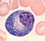 plasmocyte.jpg